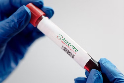 Pacchetto Check-up base al Laboratorio Assomed di Lamezia Terme